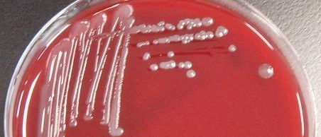 C. canimorsus (5).jpg