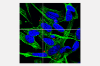 On the tracks of SARS-CoV-2 in neuroblastoma and glioblastoma cell lines